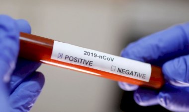 Goiás confirma 20.783 mortes e 742.606 casos da doença